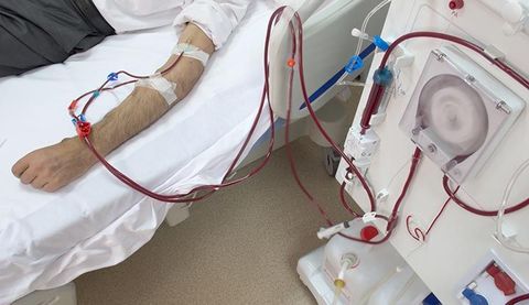 Kidney Dialysis Guide: Treatment Options, Care Planning, and Health Resources