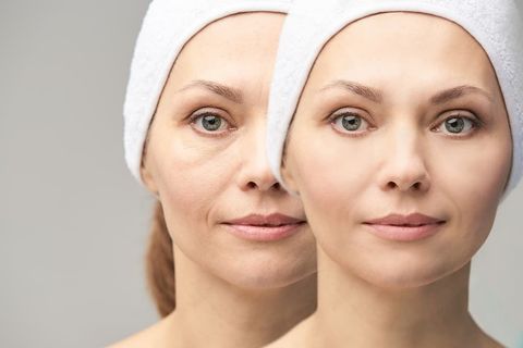 Top Facial Rejuvenation Tips to Improve Skin Texture Naturally