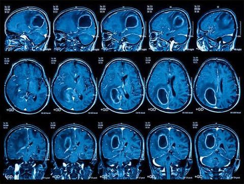 Guide to Medical Imaging: Diagnostic Tests, Imaging Procedures, and Healthcare Information
