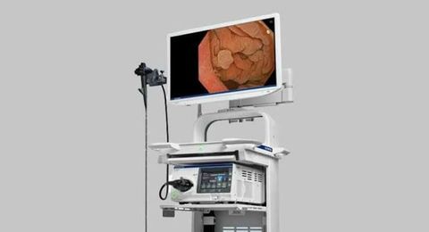 Endoscopy System Guide: Explore Equipment Component, Imaging Technology & Healthcare Technology Overview