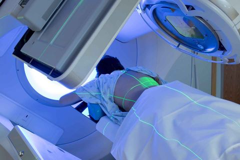 Radiation Therapy Guide: Treatment Technology, Planning Systems, and Cancer Care Information