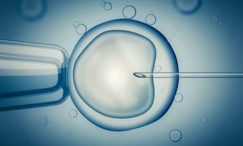 IVF Treatment Risks Guide: Explore Potential Complications, Side Effects & Important Considerations