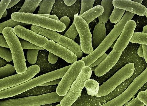 Avium Infection Complete Guide to Causes Symptoms Diagnosis and Treatment