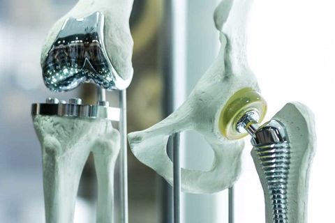 Medical Implant Materials Guide for Healthcare Manufacturers