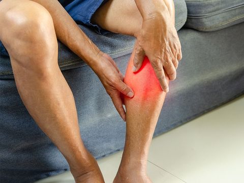 Leg Cramps Treatment Complete Guide to Relief Prevention and Muscle Health