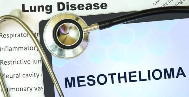 Mesothelioma Law Guide: Asbestos Exposure, Legal Claims, and Compensation