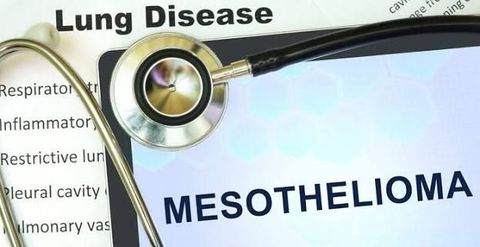 Mesothelioma Law Guide: Asbestos Exposure, Legal Claims, and Compensation