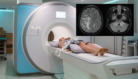 MRI Scan Guide: Imaging Procedures, Preparation, and Medical Information
