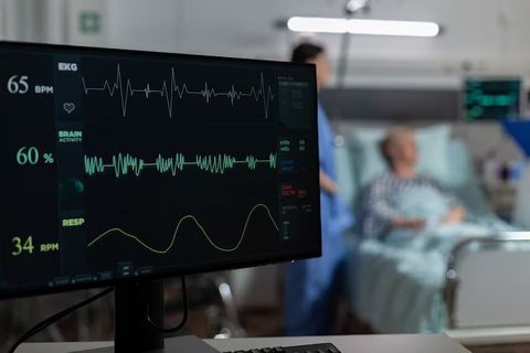 Discover ECG Machines: An Introduction to Modern Electrocardiography Systems