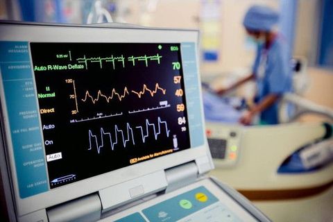 ECG Machine Guide: Explore Working Principles, Components, Features & Experts Insights