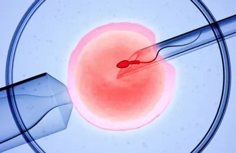 IVF Treatment Guide: Fertility Procedures, Testing, and Family Planning Information