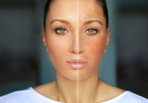 Full Face Tone Balancing Explained: Explore Basics, Facts, and Essential Information