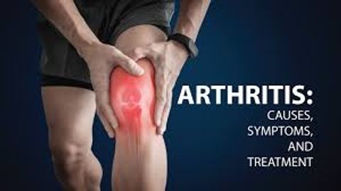 Discover 15 Hospitals in the USA Offering Free Arthritis Treatments – A Complete Guide