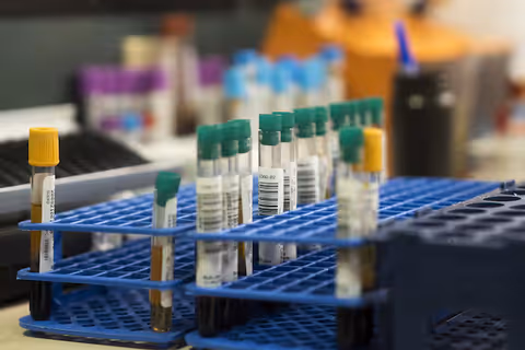 Single Use Sampling Systems: Insights Into Designs, Applications and Sampling Methods