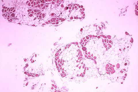 Guide to Duchenne Muscular Dystrophy Research