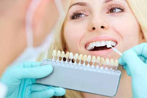Guide to Cosmetic Dentistry: Dental Veneers, Teeth Whitening, and Smile Restoration