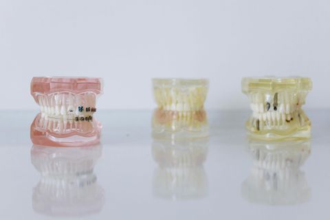 Dental Implant Guide: Explore Procedure Basics, Care Tips & Expert Insights