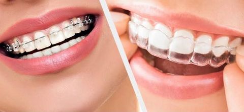 Dental Implant Guide: Implant Types, Treatment Procedures, or Oral Care
